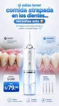 IRRIGADOR BUCAL